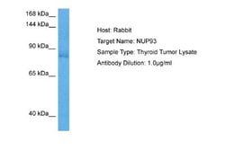 NUP93 Rabbit anti-Human, Polyclonal, Novus Biologicals 0.1 mL | Buy Online | Novus Biologicals | Fisher Scientific